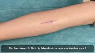 WOUND FREE Hydrogel Wound Dressings