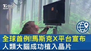 全球首例! 馬斯克X平台宣布 人類大腦成功植入晶片｜TVBS新聞