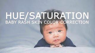 How i fix baby rash reddish skin in photoshop