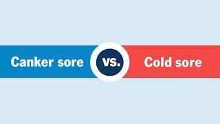 Cold Sores vs. Canker Sores — Which Is It?