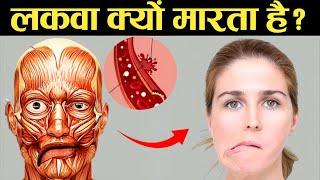 लकवा कैसे मारता है? How does paralysis occur ?