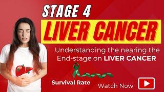 Stage 4 LIVER CANCER | Understanding the  nearing the end-stage on LIVER CANCER | Survival Rates