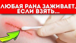 Разок-другой и зажило! Как применить народную медицину и классическую обработку для исцеления ран