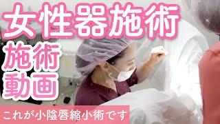 【小陰唇縮小術】施術解説動画大公開！女性器のお悩み解消！デリケートゾーンの施術！【VIO整形】