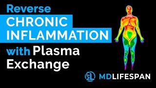 Reverse Chronic Inflammation with Plasma Exchange at MDLifespan