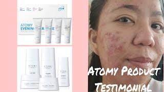 ATOMY THE FAME SKIN CARE SET | ATOMY EVENING CARE 4 SET | BEFORE AND AFTER