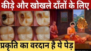 सड़े गले दांतों को ठीक कैसे करे | Home Remedies to cure tooth cavity and infection