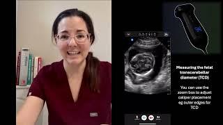 iQ3 reviewed by Dr. Cecilia Leggett, Maternal Fetal Medicine fellow at Stanford University