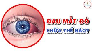 Đau mắt đỏ chữa thế nào?