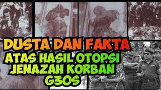 Dusta Dan Fakta Atas Otopsi Jenazah Para Jenderal Korban G30S