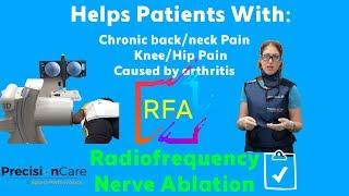 Radiofrequency Nerve Ablation (RFA) - Back and Neck Pain Treatment