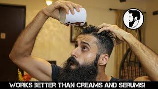 How To Get Thick Hair Naturally - Part 1 | Bearded Chokra