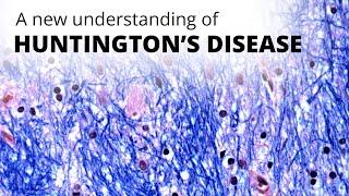 A new understanding of Huntington's disease