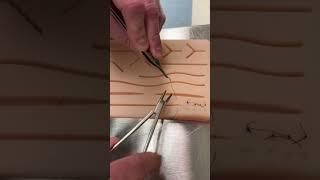 Horizontal mattress suture