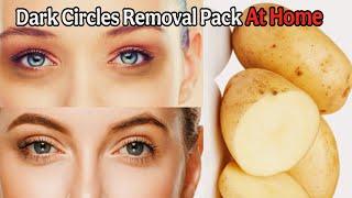 Dark Circles Removal Pack AT Home | Dark Circles Under Eyes Remedy !
