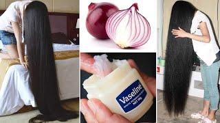 How to use Vaseline and onion to grow hair 2 cm per day Very fast |||