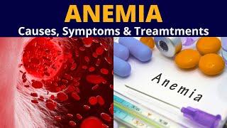 What is Anemia | Anemia causes | symptoms | Treatment |