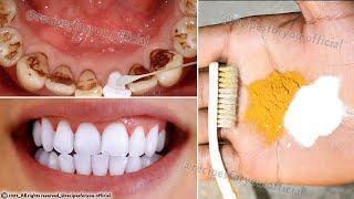Secret that Dentists don't want you to know: Remove Tartar and Teeth Whitening in just 2 minutes