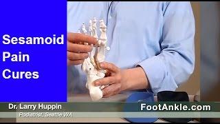 What are the Best Treatments for Sesamoiditis with Seattle Podiatrist Dr  Larry Huppin