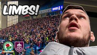 ZIAN FLEMMING FIRES BURNLEY TO EAST LANCS DERBY WIN!!! | BLACKBURN ROVERS VS BURNLEY | MATCHDAY VLOG