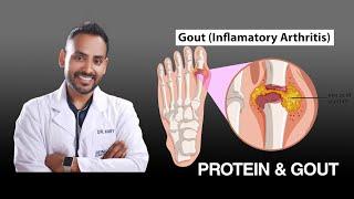 के प्रोटिन र रातो मासुले युरिक एसिड निम्त्याउँछ? | dietary protein doesn't cause uric acid why ? P1