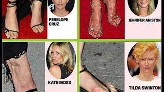 To10 CELEBRITIES WITH THE UGLIEST FEET