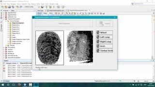 Fingerprint Classification | Pattern Recognition