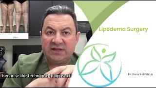 Lipedema Surgery - Dr. Boris Volshteyn