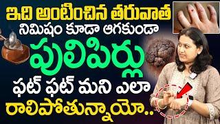 Dr. Jyothsna Pulipati - నొప్పి లేకుండా పులిపిర్లు మాయం || Home Remedies For Pulipirlu || SumanTV