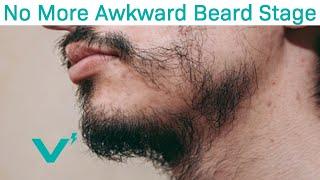 Skip The "Awkward Beard Stage" With These Tips