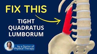Is a Tight QL Causing Your Back Pain? | Quadratus Lumborum Muscle Tightness