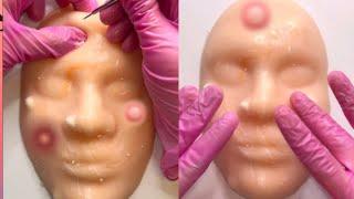 ASMR Popping Mannequin Pimples!!!