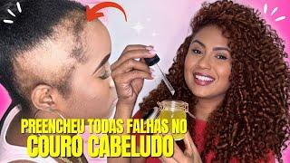 APENAS TRÊS INGREDIENTES O CABELO CRESCE MUITO E NÃO CAI| NÃO USE MUITO!