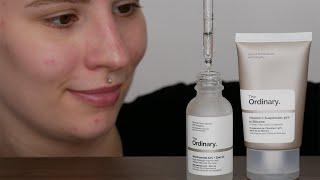 The Ordinary Niacinamide 10% + Zinc 1% and Vitamin C - Do’s and Don'ts - Simplified Regimen Guide