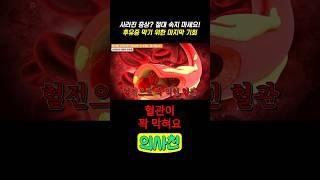 사라진 증상? 절대 속지 마세요! 후유증 막기 위한 마지막 기회 #건강 #뇌졸중 #뇌혈관 #뇌혈관질환 #뇌경색 #뇌건강