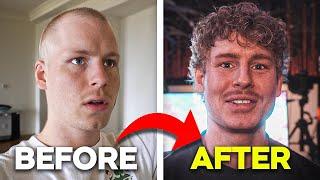 I Lost All My Hair, This is How I Fixed it!