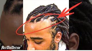 How to avoid HAIRLINE DAMAGE |Quick Tip With ActDaVerse #shorts