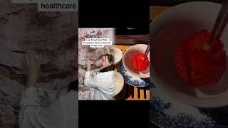 What Americans think universal healthcare is like #usa #american #europe #european #funny