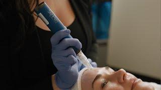 SkinPen® Microneedling & Exosomes | Elevate Your Microneedling Treatment for Total Skin Rejuvenation