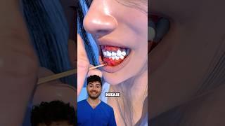 Gum Color Meaning - Dentist Explained