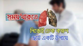 করোনাকালে ফুসফুসের কার্যকারিতা সঠিক রাখতে যা করবেন - Alok Roy Topu Lifestyles