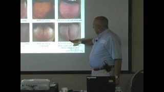 Giovanni Maciocia Tongue Diagnosis: Heart Crack (Obstruction of Shen) -- Online Acupuncture CEU