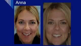 Cosmetic Dentistry Before and Afters from Dr  William Linger