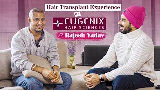 Actor, Influencer and YouTuber Rajesh Yadav Shares His Hair Transplant Experience at Eugenix Gurgaon