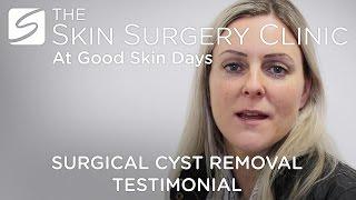 Cyst Removal | Adele's Testimonial