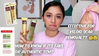 TCM SCAR AND ACNE MARK REMOVAL GEL OINTMENT 1 Tube Review and How to know if its Fake or Authentic ?