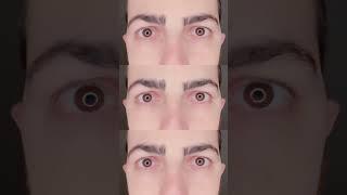 Struggling with panic attacks and migraines? Your vision might be the missing piece!  If your