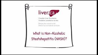 Non-alcoholic steatohepatitis (NASH) - Liver Disease Educational Video Series