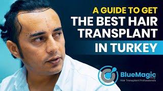 A Guide to get The BEST Hair Transplant in Turkey | BlueMagic Group Clinic