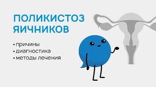 Поликистоз яичников